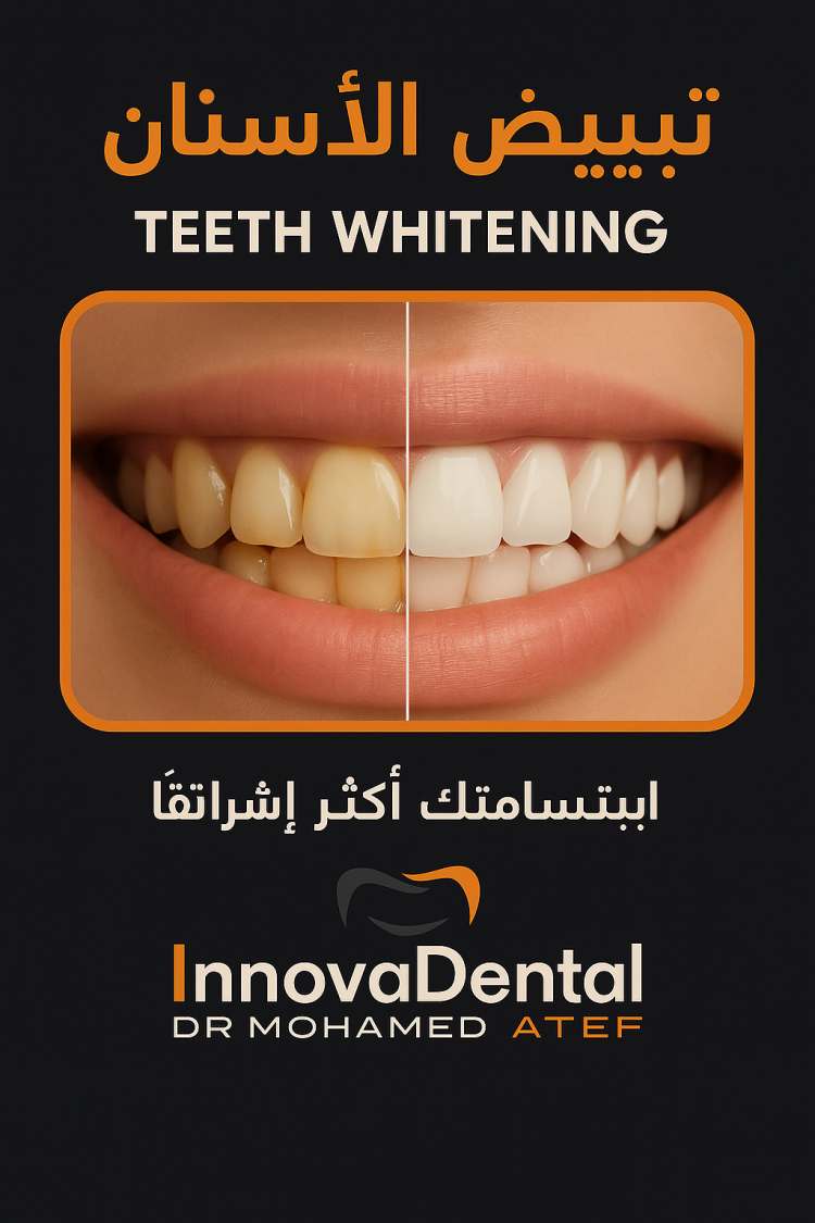 Teeth whitening
